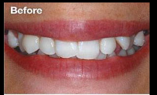 Quisque venenatis mi at