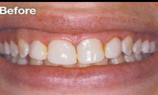 Quisque venenatis mi at