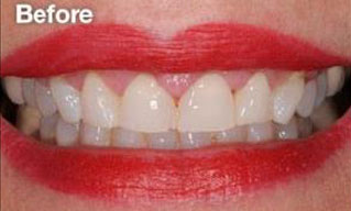 Quisque venenatis mi at