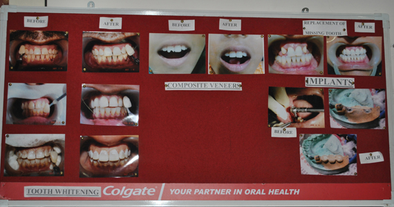 Commodo purus sit amet